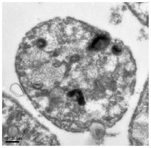 Application of aspirin in preparation of platelet targeted drug delivery system