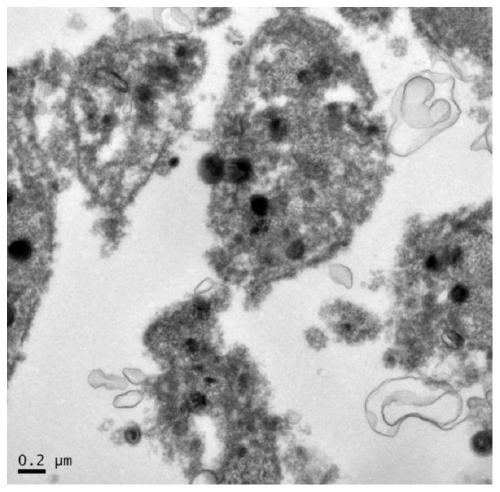 Application of aspirin in preparation of platelet targeted drug delivery system