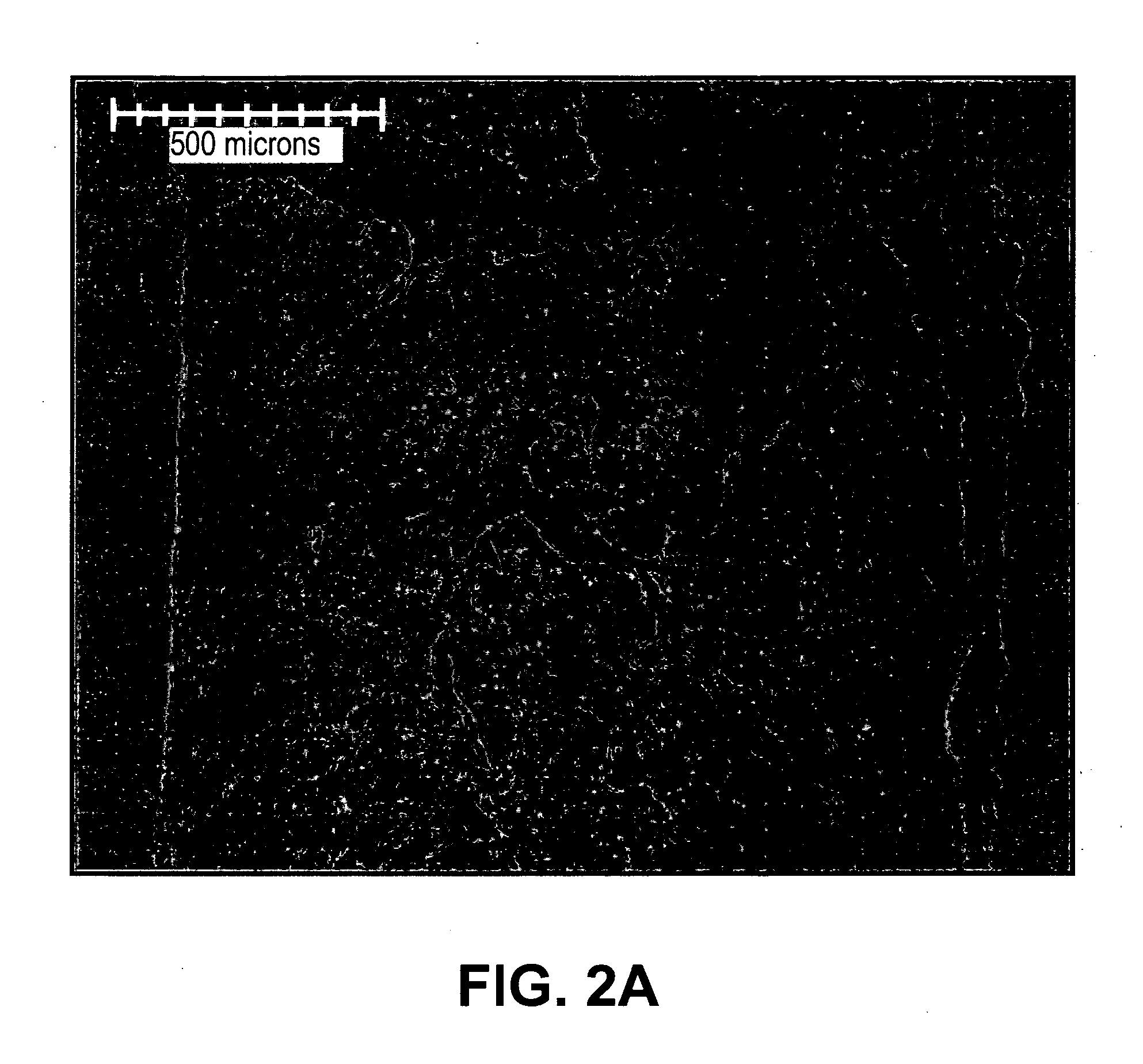 Devices with Anti-thrombogenic and Anti-microbial treatment