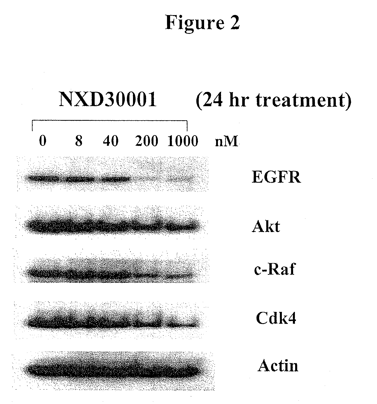 Treatment Of Neurofibromatosis With Radicicol And Its Derivatives