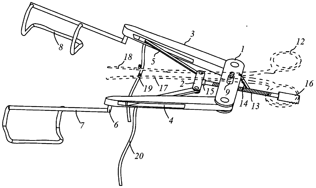 Pre-auricular fistula surgery auxiliary device