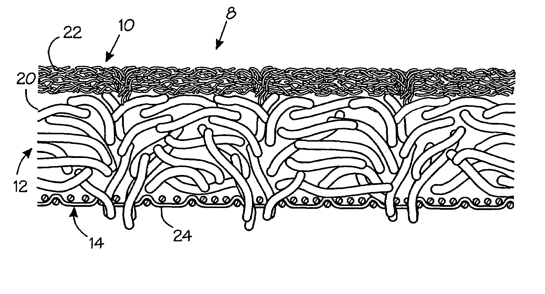 Papermakers felt having a point-bonded web layer formed of coarse fibers