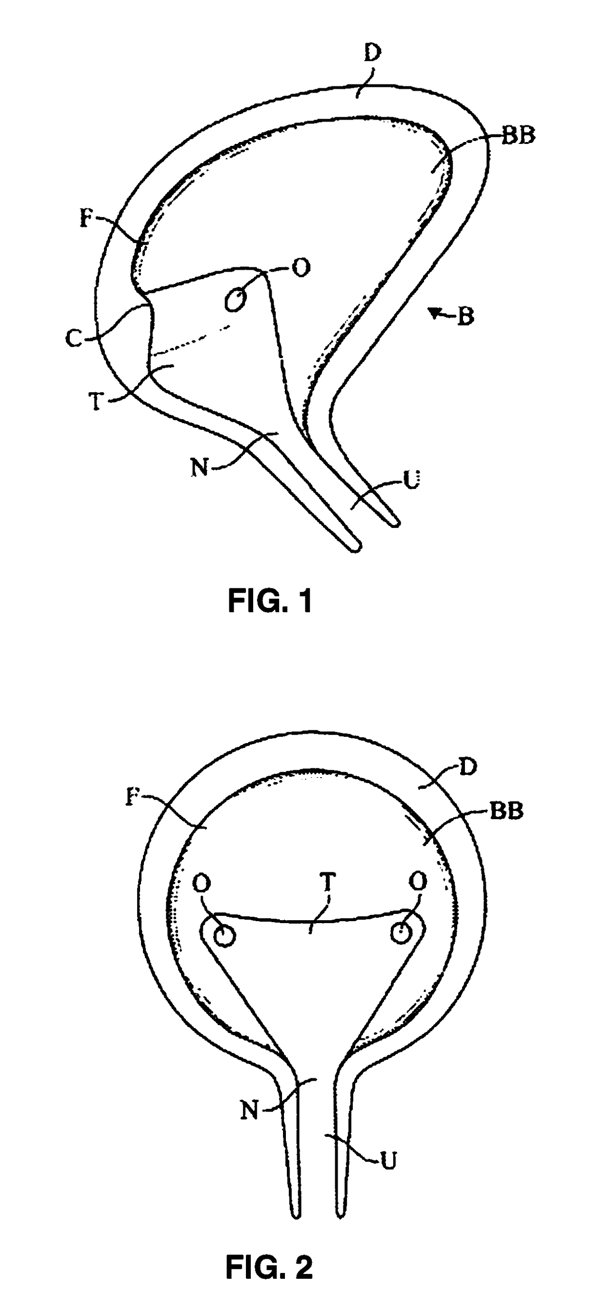 Methods and Devices for Treating Pelvic Conditions