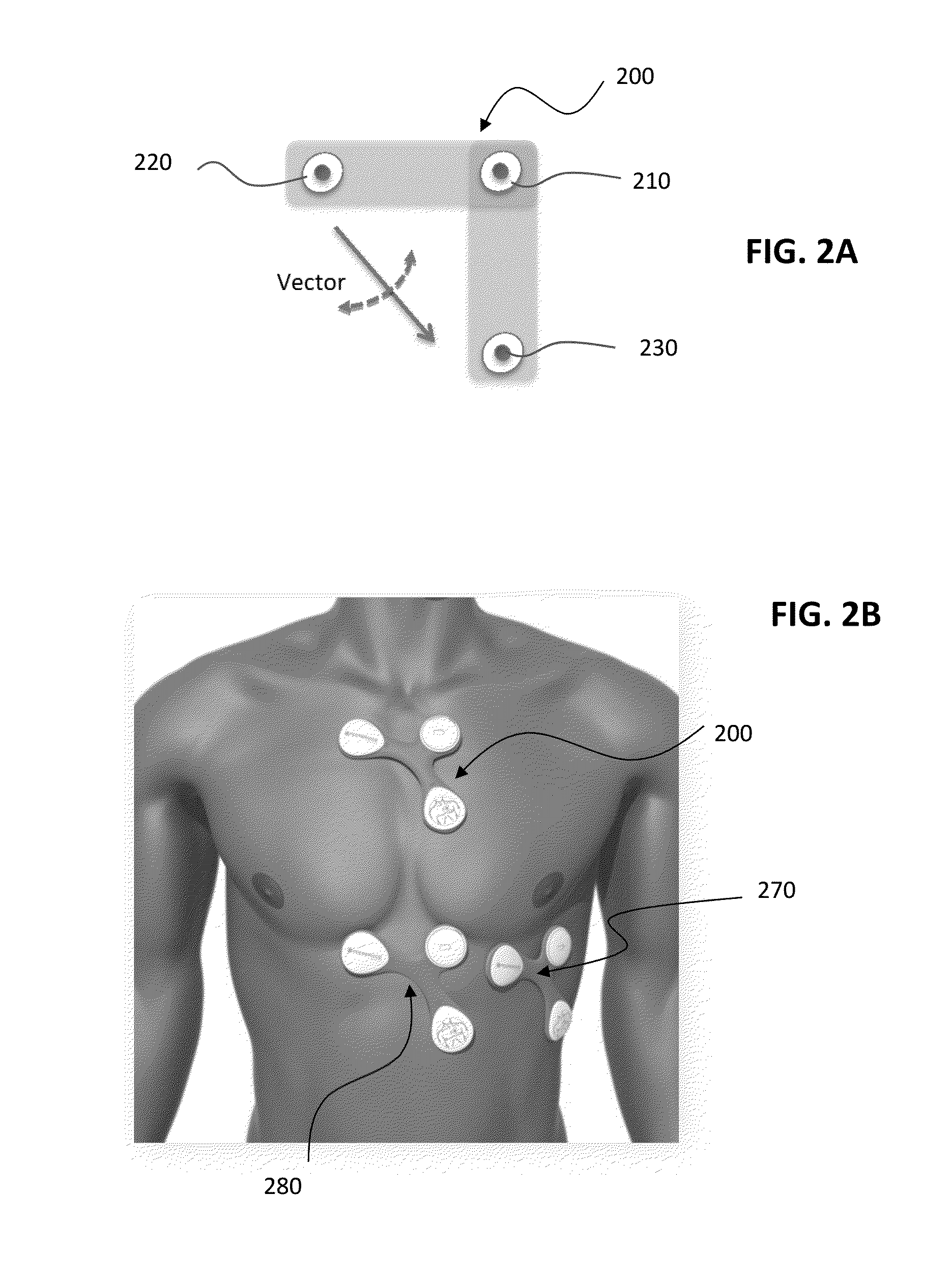 System and method for monitoring and diagnosing patient condition based on wireless sensor monitoring data