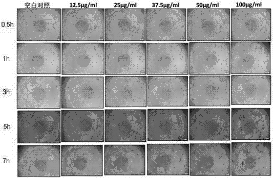 Application of polysaccharide sulphate to preparation of tumor treatment neovascularization inhibitors and vascular disrupting agents