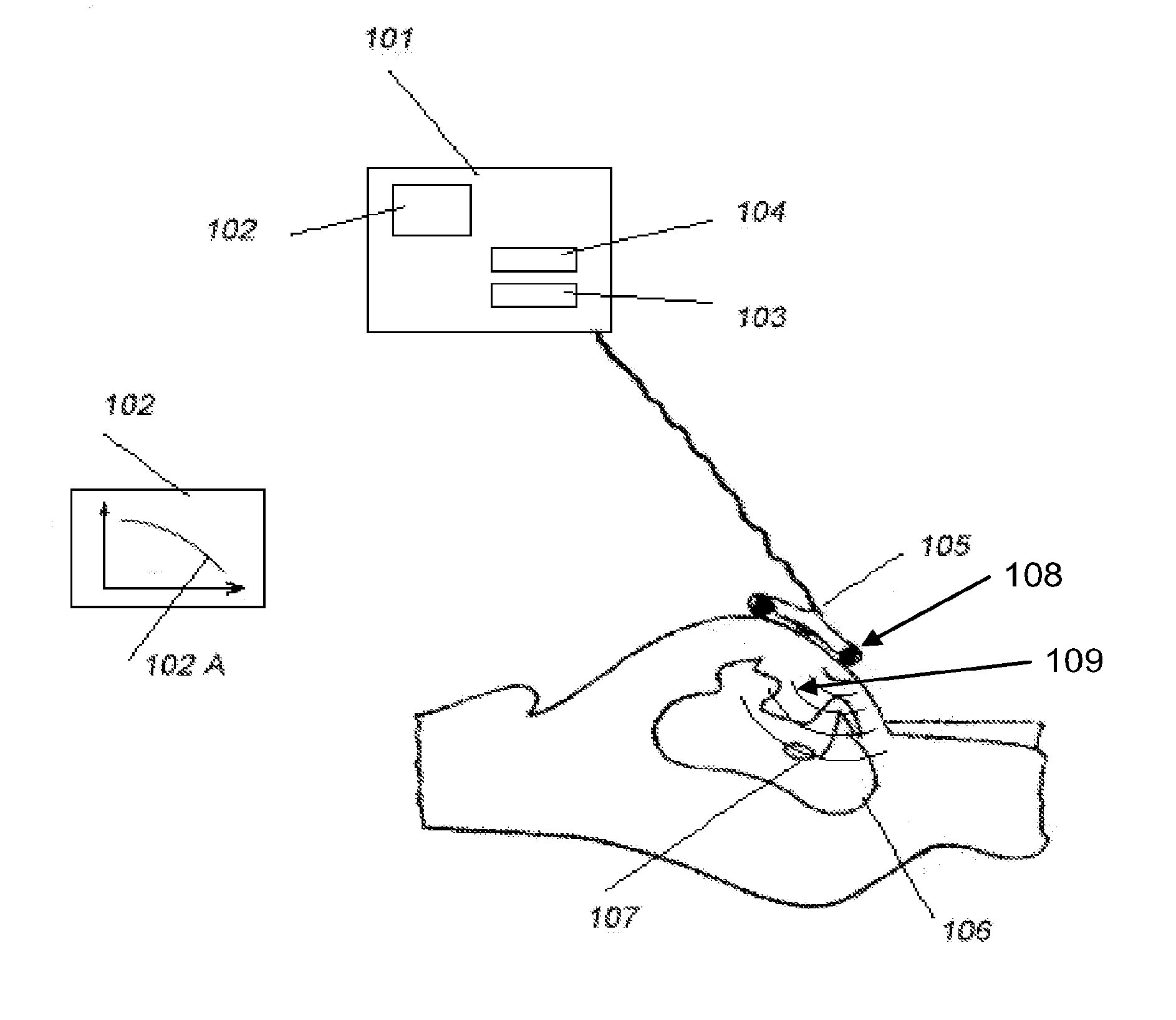 Method and a System for Monitoring, Contractions and/or a Birth Process and/or the Progress and/or Position of a Fetus