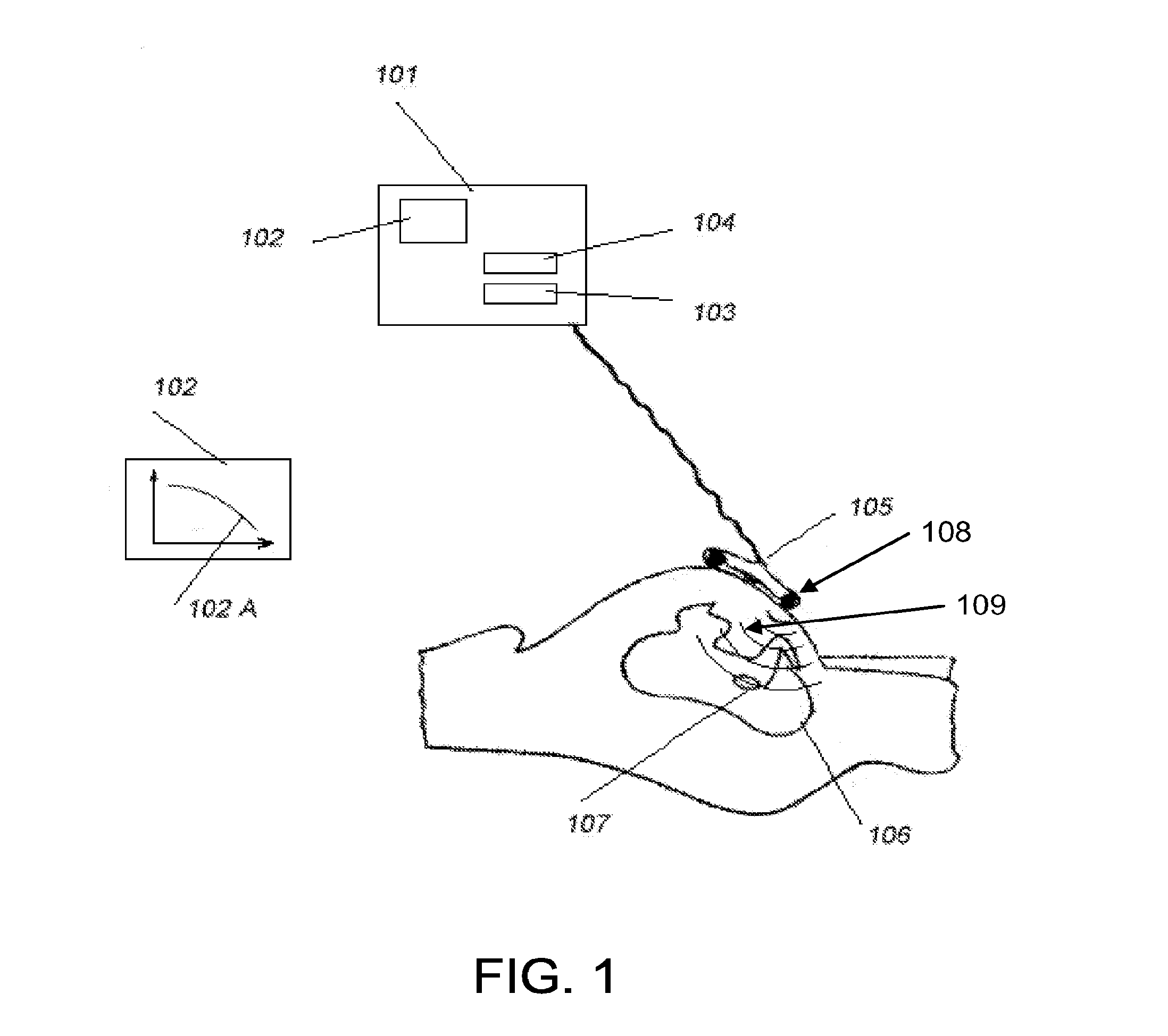 Method and a System for Monitoring, Contractions and/or a Birth Process and/or the Progress and/or Position of a Fetus