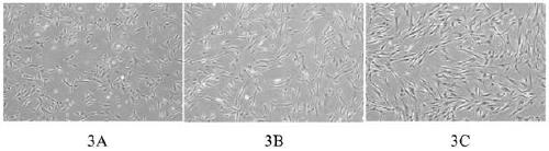 A kit for culturing huc-msc step by step and huc-msc obtained by using the kit