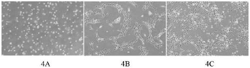 A kit for culturing huc-msc step by step and huc-msc obtained by using the kit