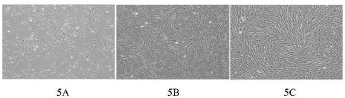 A kit for culturing huc-msc step by step and huc-msc obtained by using the kit