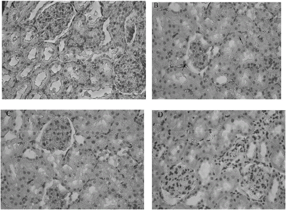 Medicine for preventing and treating diabetes and diabetic nephropathy, and synthetic method and application thereof