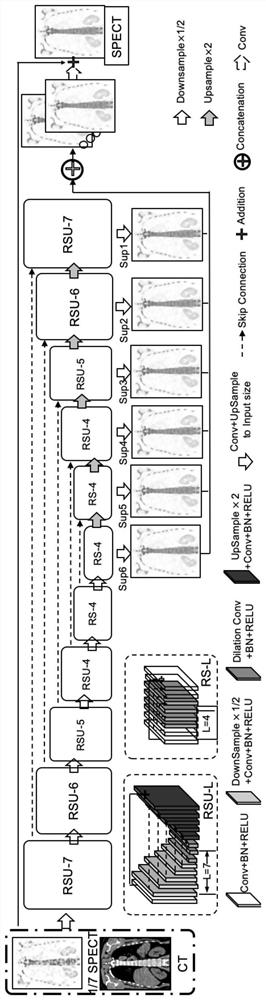 SPECT imaging prediction model creation method and device, equipment and storage medium