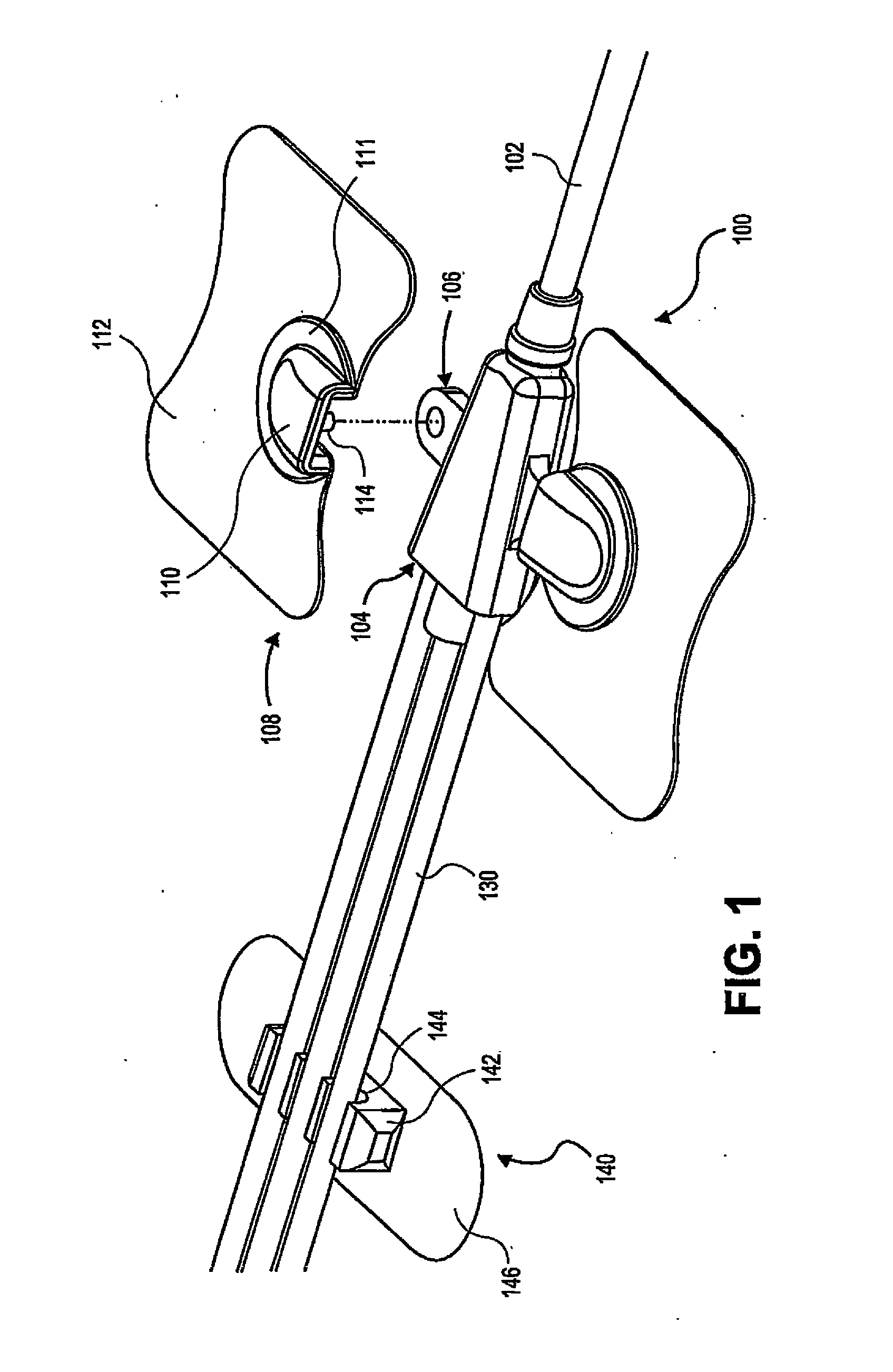 Catheter securement devices