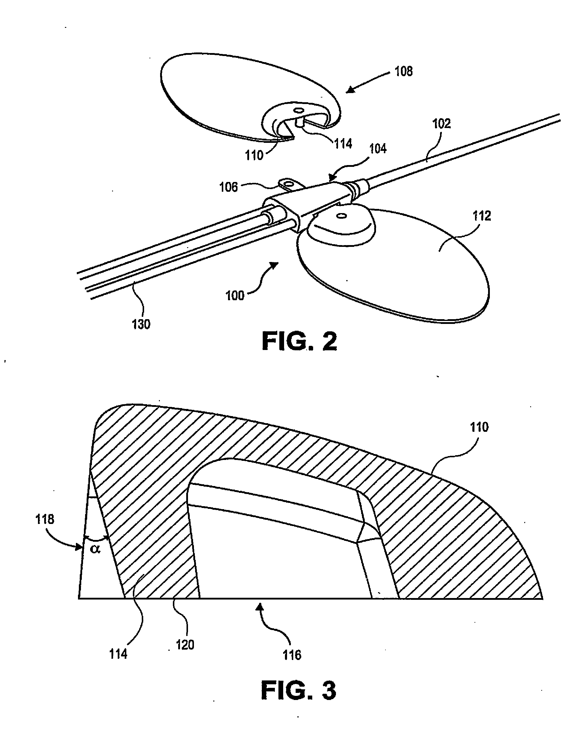 Catheter securement devices