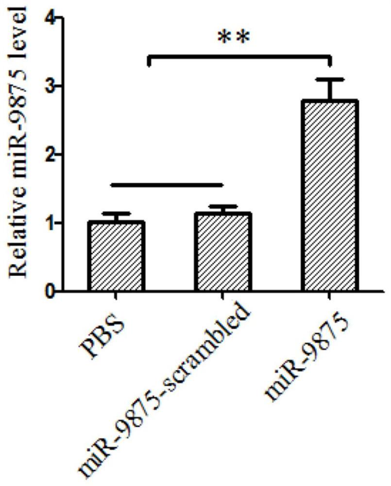 Application of antisense nucleic acid amo-mir-9875 in preparation of anti-white spot syndrome virus preparation