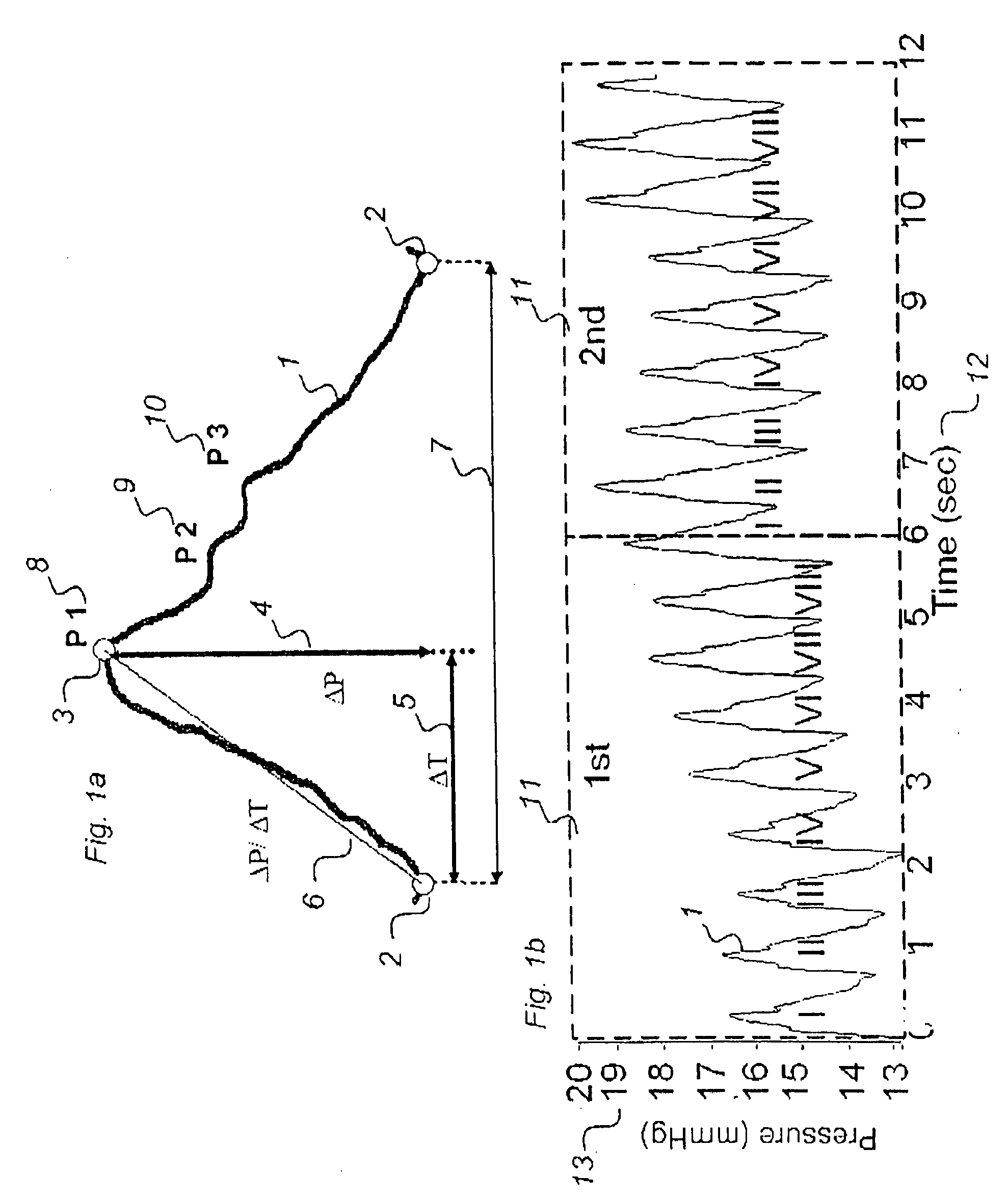 Method for analysis of single pulse pressure waves