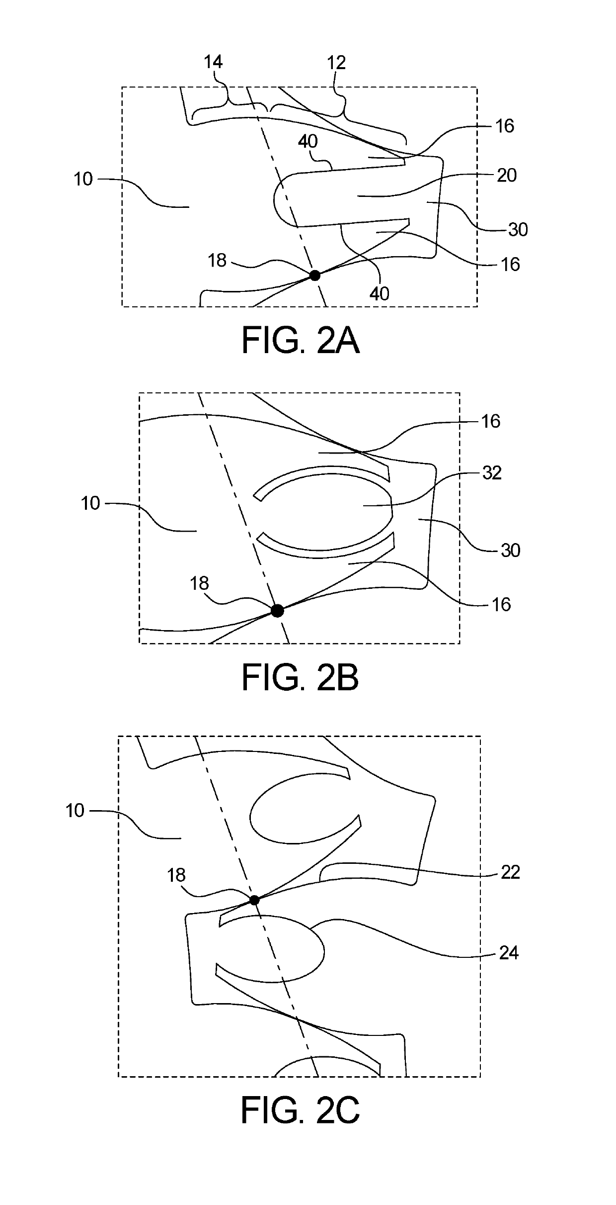 Device and Method of Gear Noise Reduction