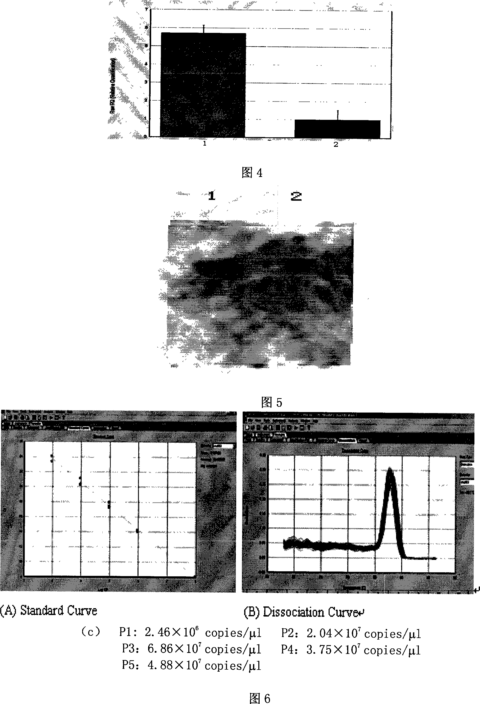 Yeast proliferation model of human papilloma virus as well as constructing method and uses