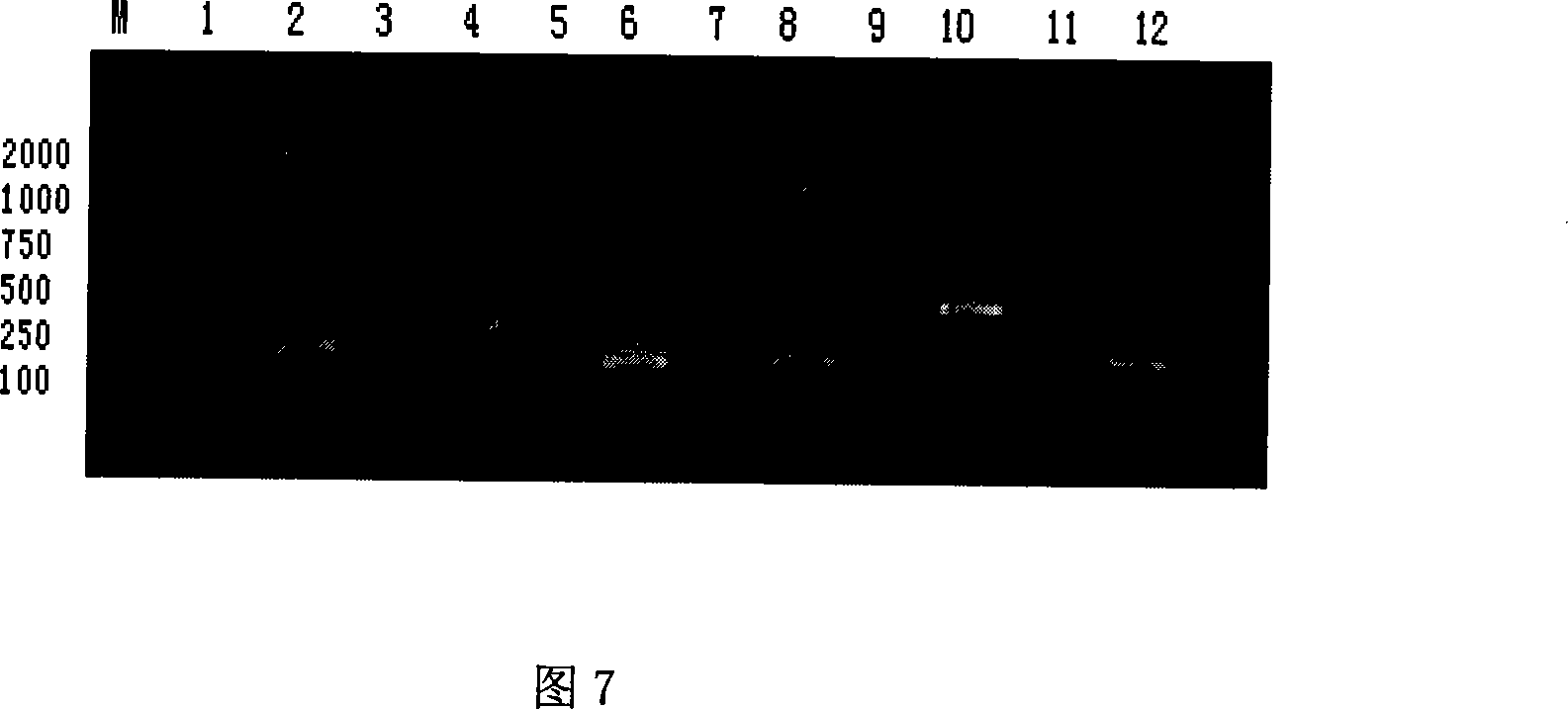 Yeast proliferation model of human papilloma virus as well as constructing method and uses