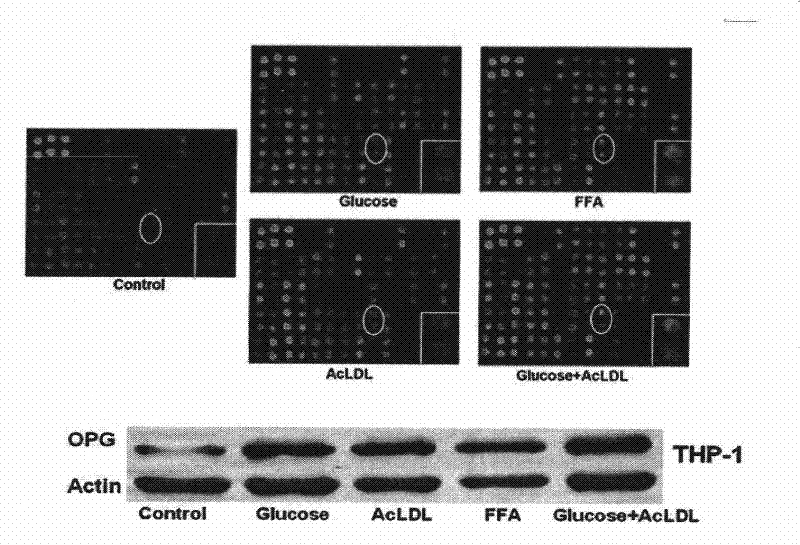 Application of miR-145 in preparing medicament for treating inflammation