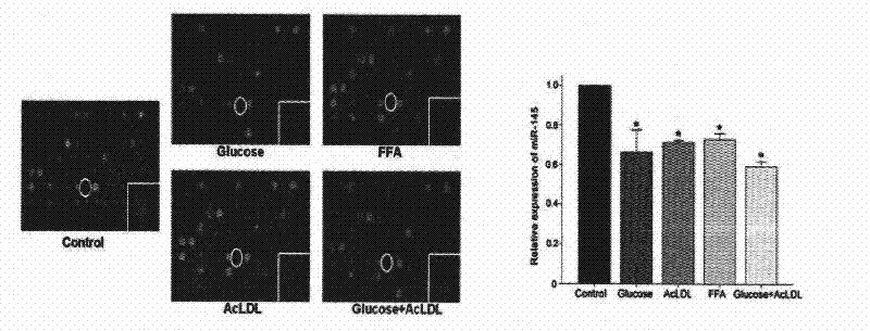 Application of miR-145 in preparing medicament for treating inflammation