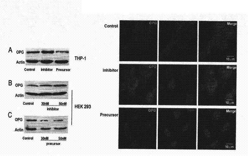 Application of miR-145 in preparing medicament for treating inflammation