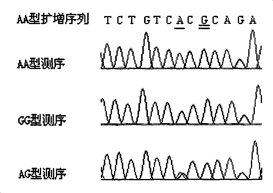 Method for detecting the polymorphism of ADH2 genes