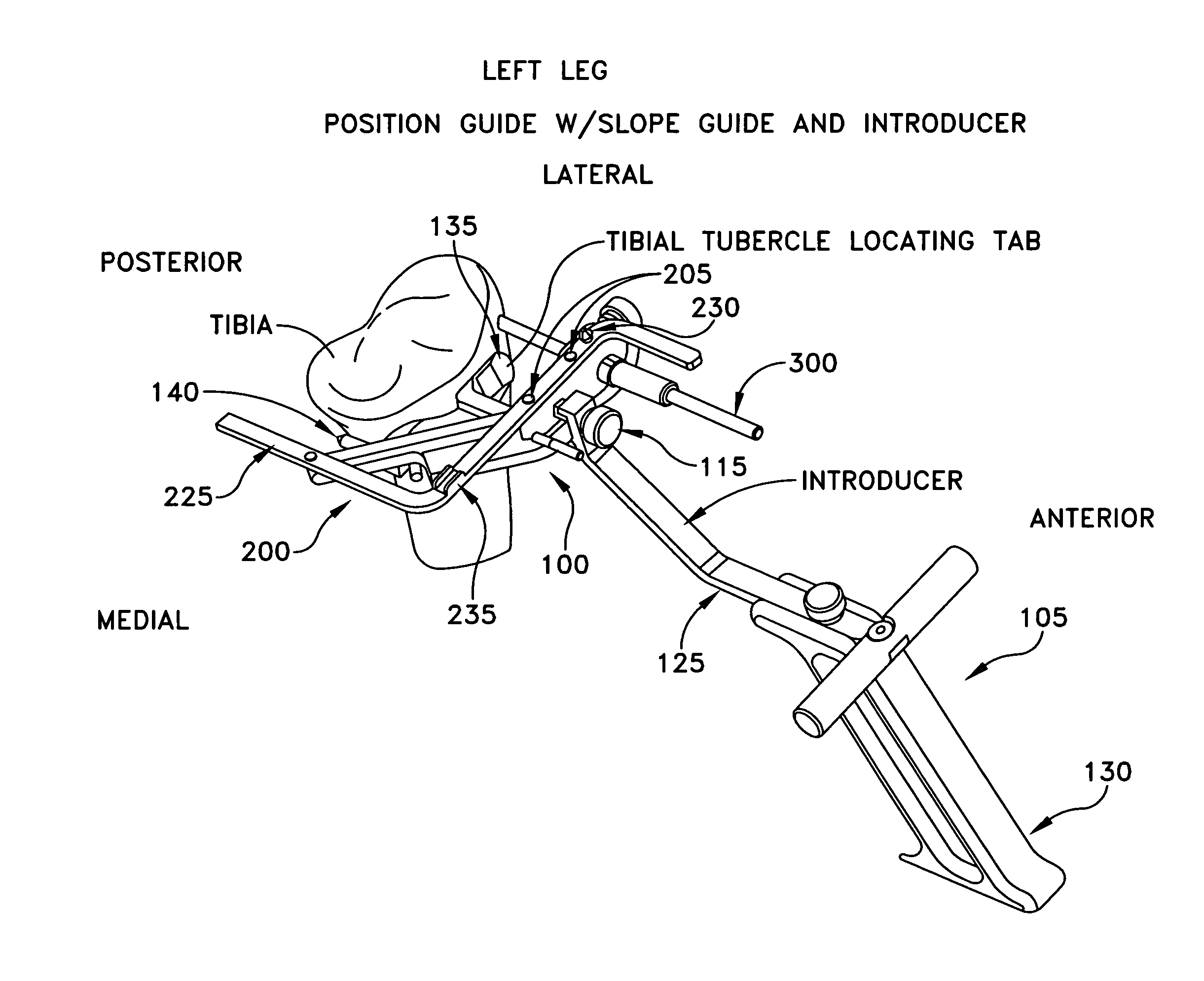 Method and apparatus for performing an open wedge, high tibial osteotomy