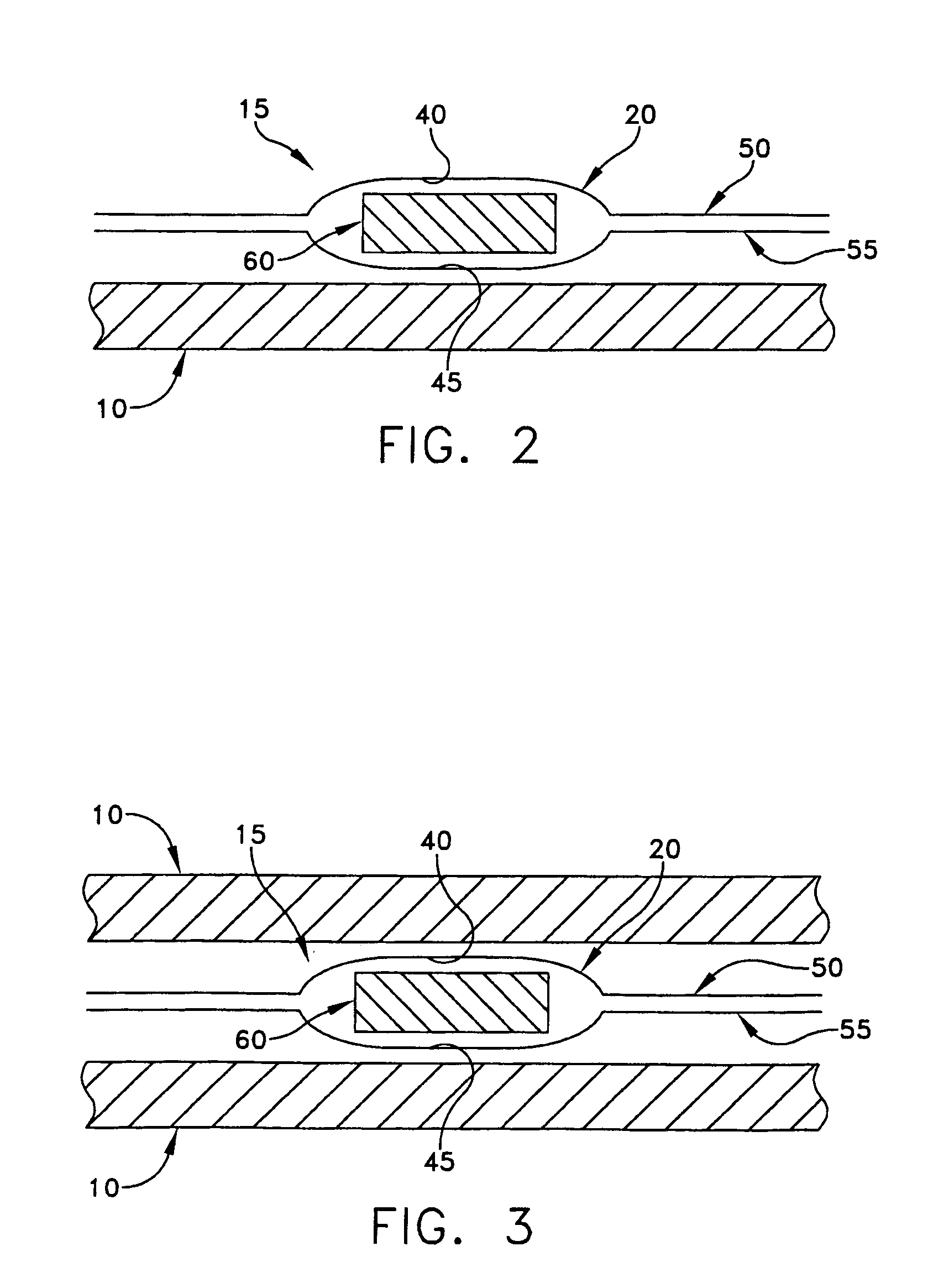 Personal cooling or warming system using closed loop fluid flow