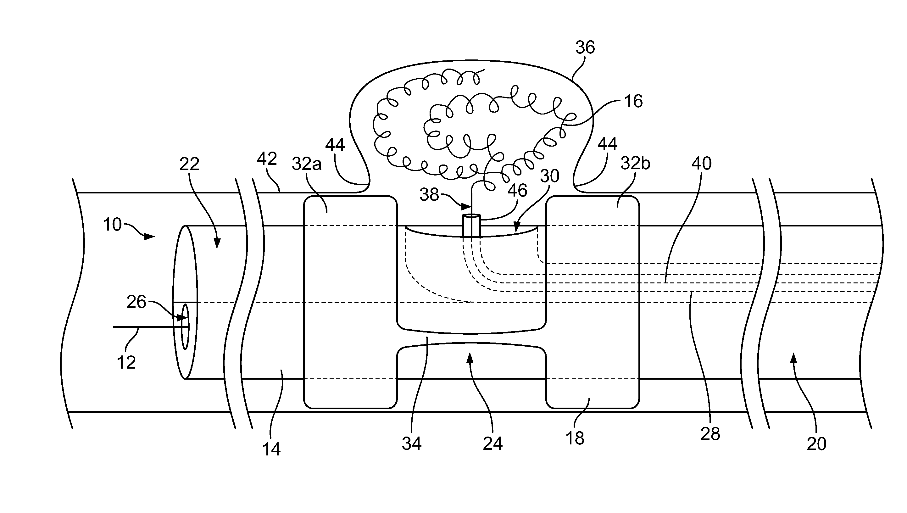 Embolic coil delivery system and method of using same