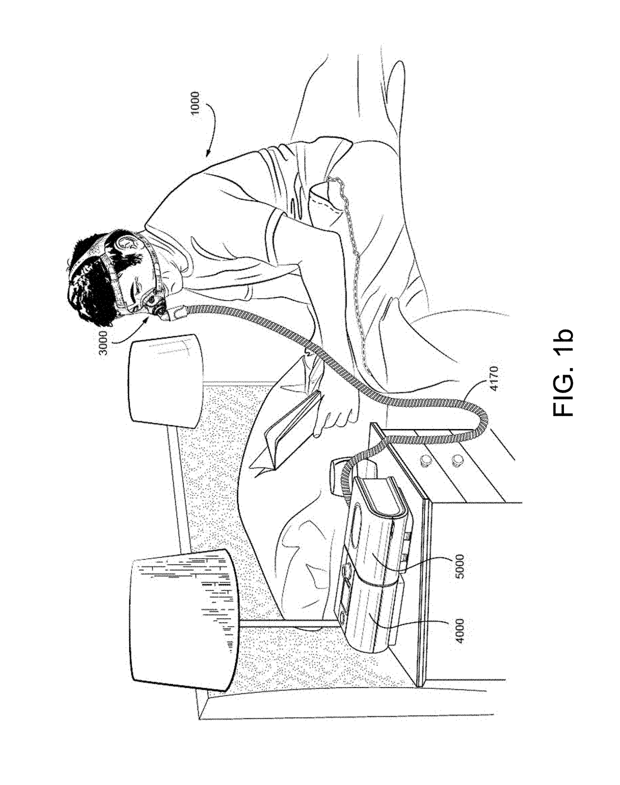 Detection of periodic breathing