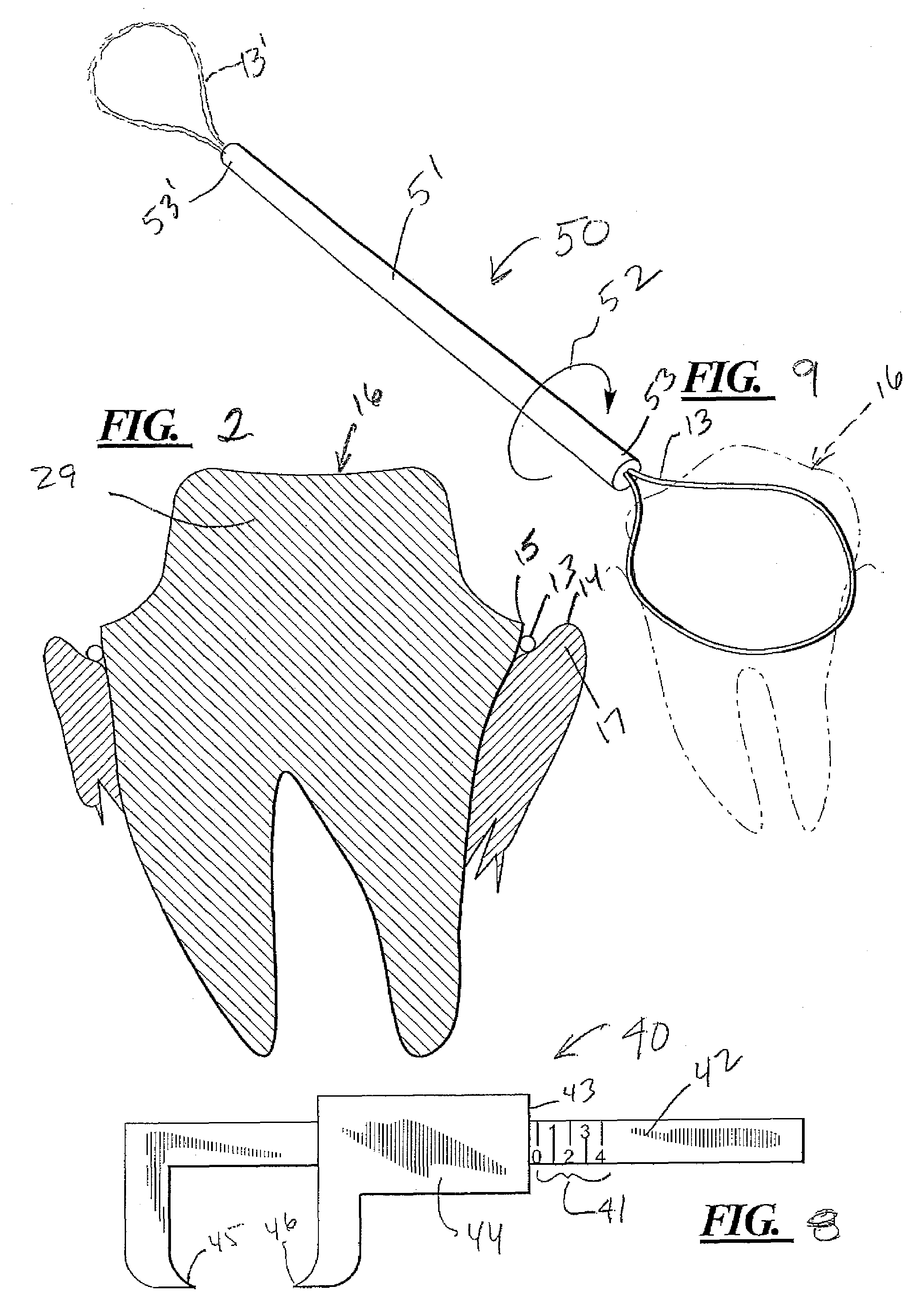 Truncated cone-shaped dental drill burr, measurement gauge and gingival cord applicator for dental crown preparation