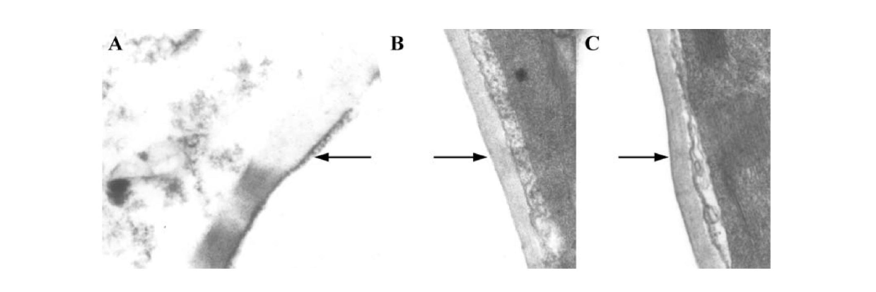 Pectate lyase PCPEL16 from phytophthora capsici, and coding gene and application thereof