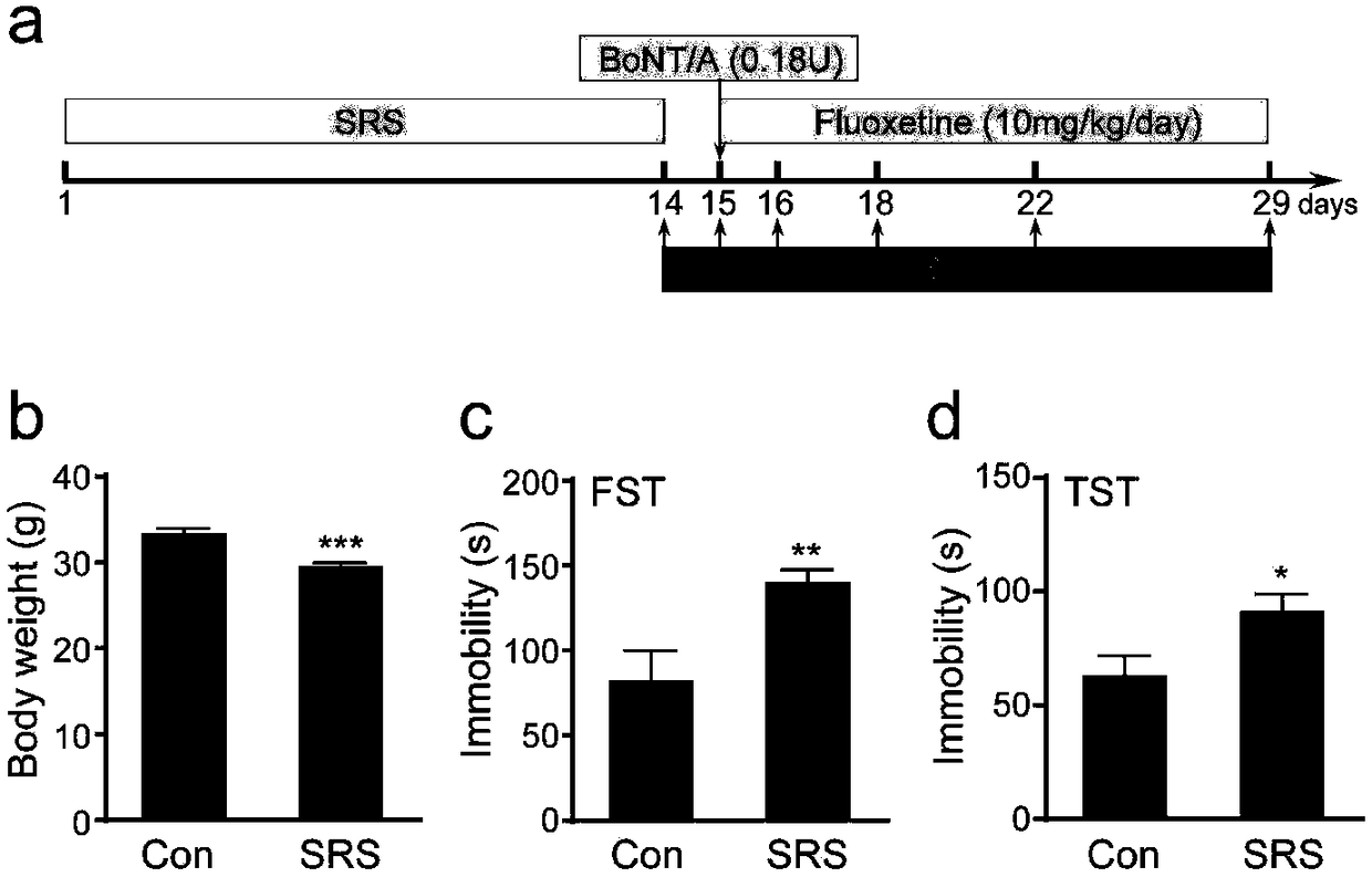 Application of botulinum toxin A to resistance of depression