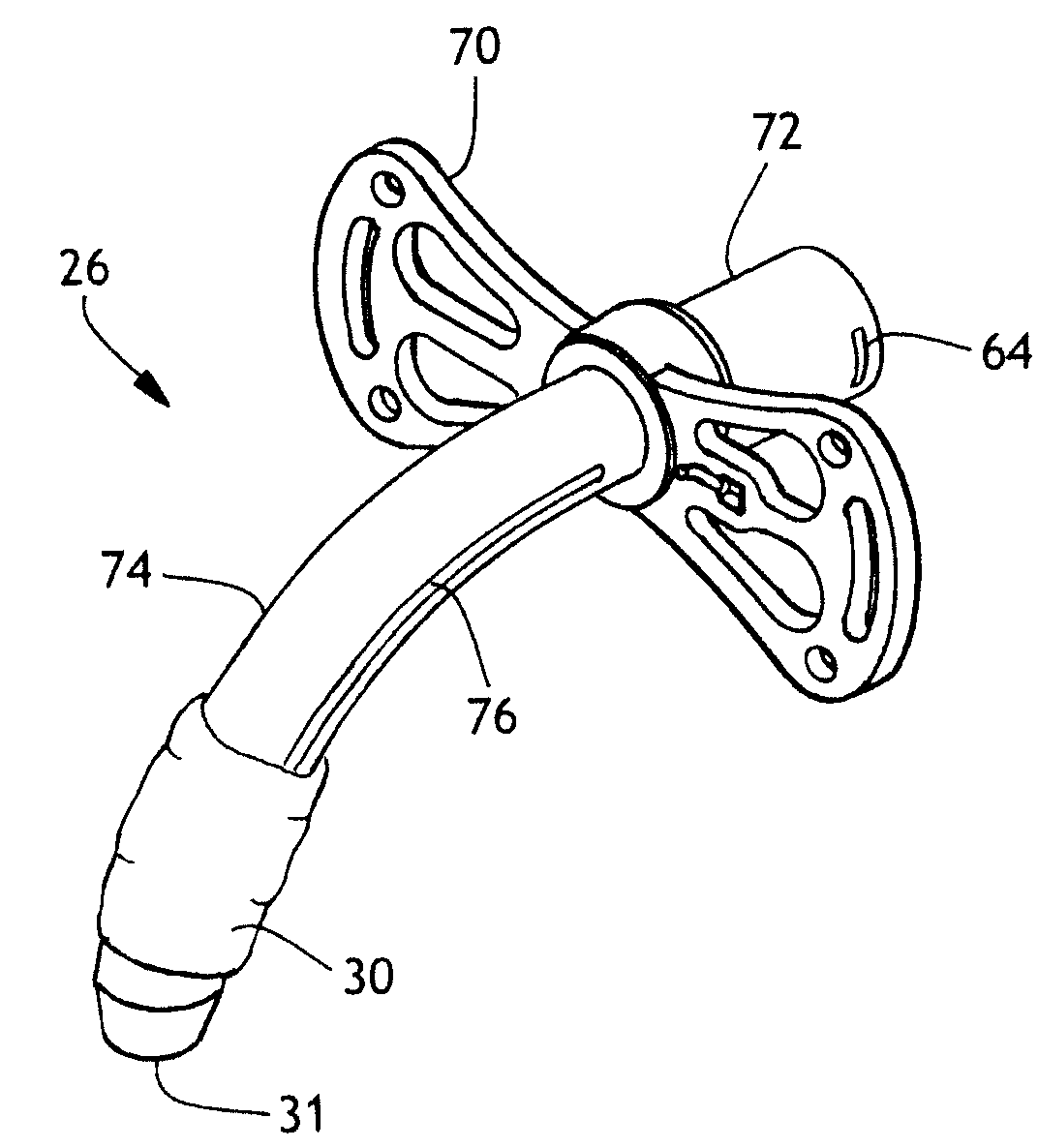 Tracheostomy Tube Butterfly Flange