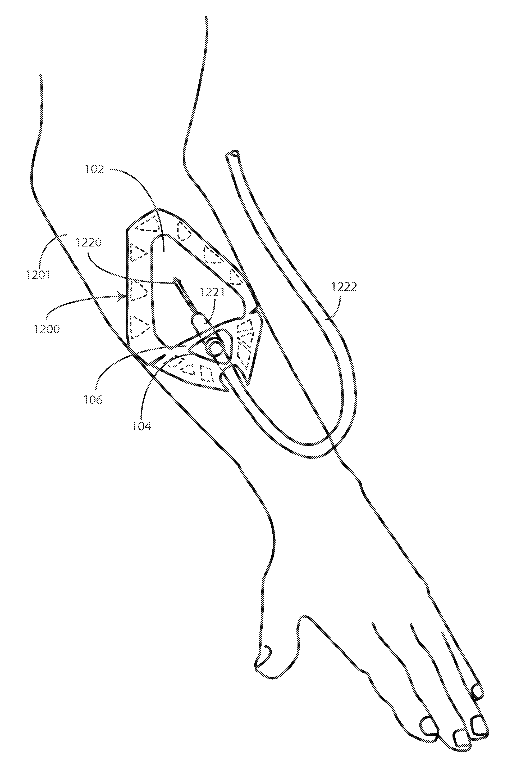 Window Dressing Having Force Concentrating Adhesion Elements