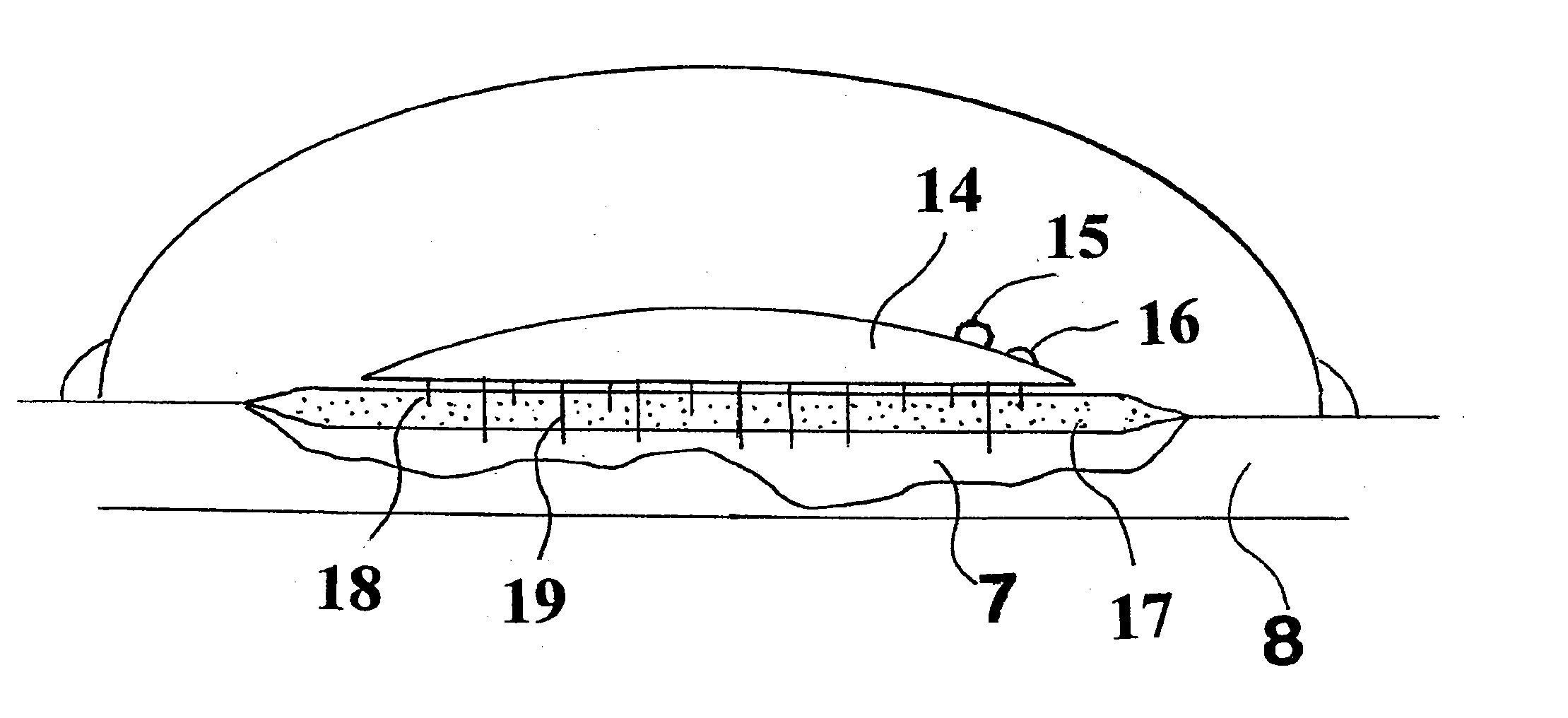 Method and apparatus for the deactivation of bacterial and fungal toxins in wounds, and for the disruption of wound biofilms