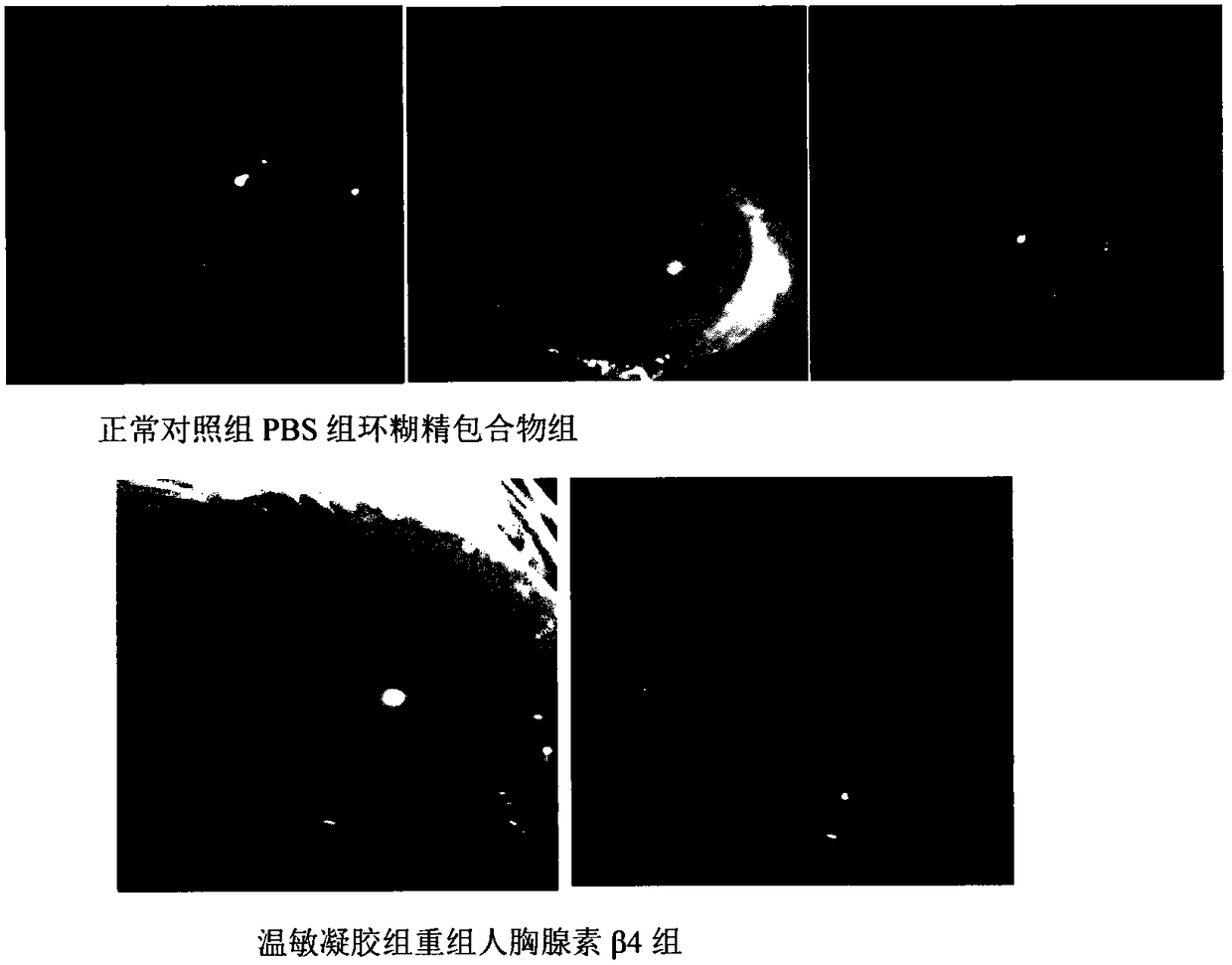 Temperature-sensitive recombinant human thymosin beta 4 eye in-situ gel preparation