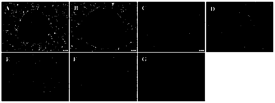 A method for preparing feeder layer cells by suspension-adherence method