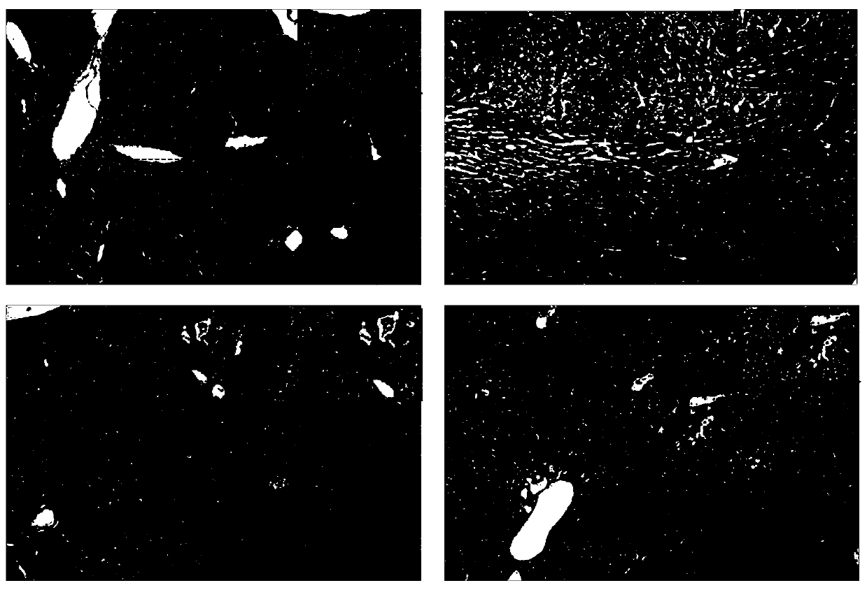 Nanometer Liushen pill solution and preparation method