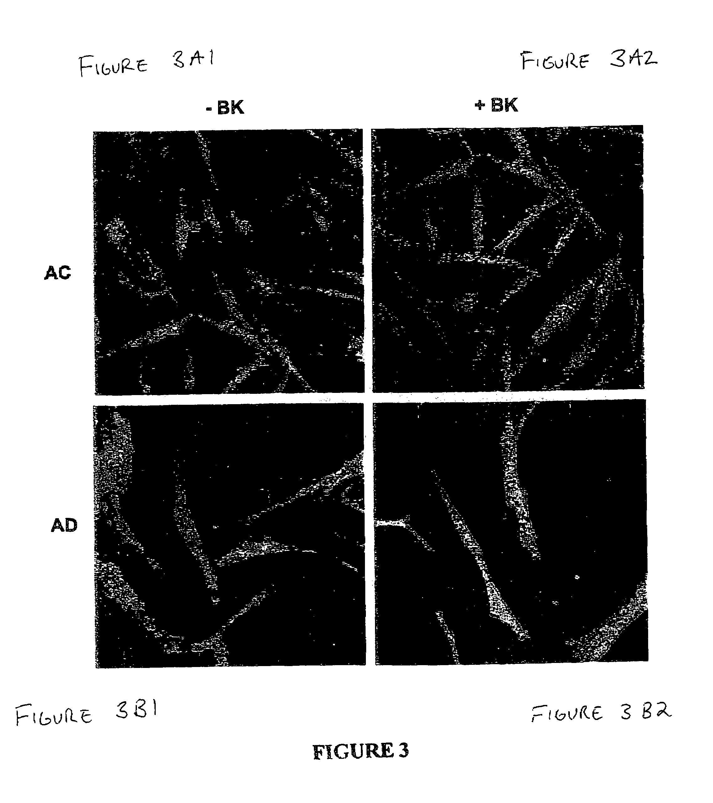 Alzheimer's disease diagnosis based on mitogen-activated protein kinase phosphorylation