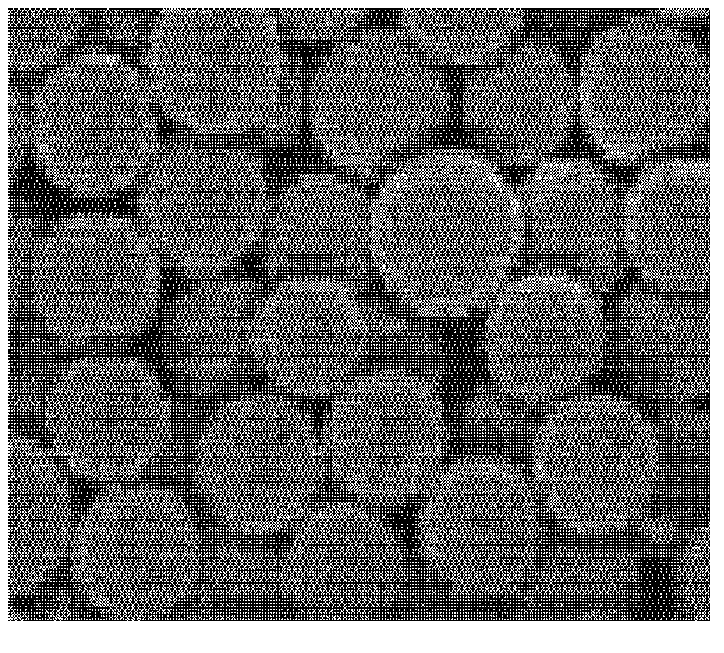 Teriparatide sustained-release microsphere and preparation method thereof