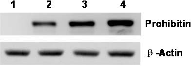 Application of Prohibitin protein antibody to preparing kit for diagnosing senile dementia