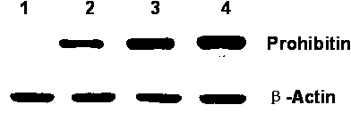 Application of Prohibitin protein antibody to preparing kit for diagnosing senile dementia