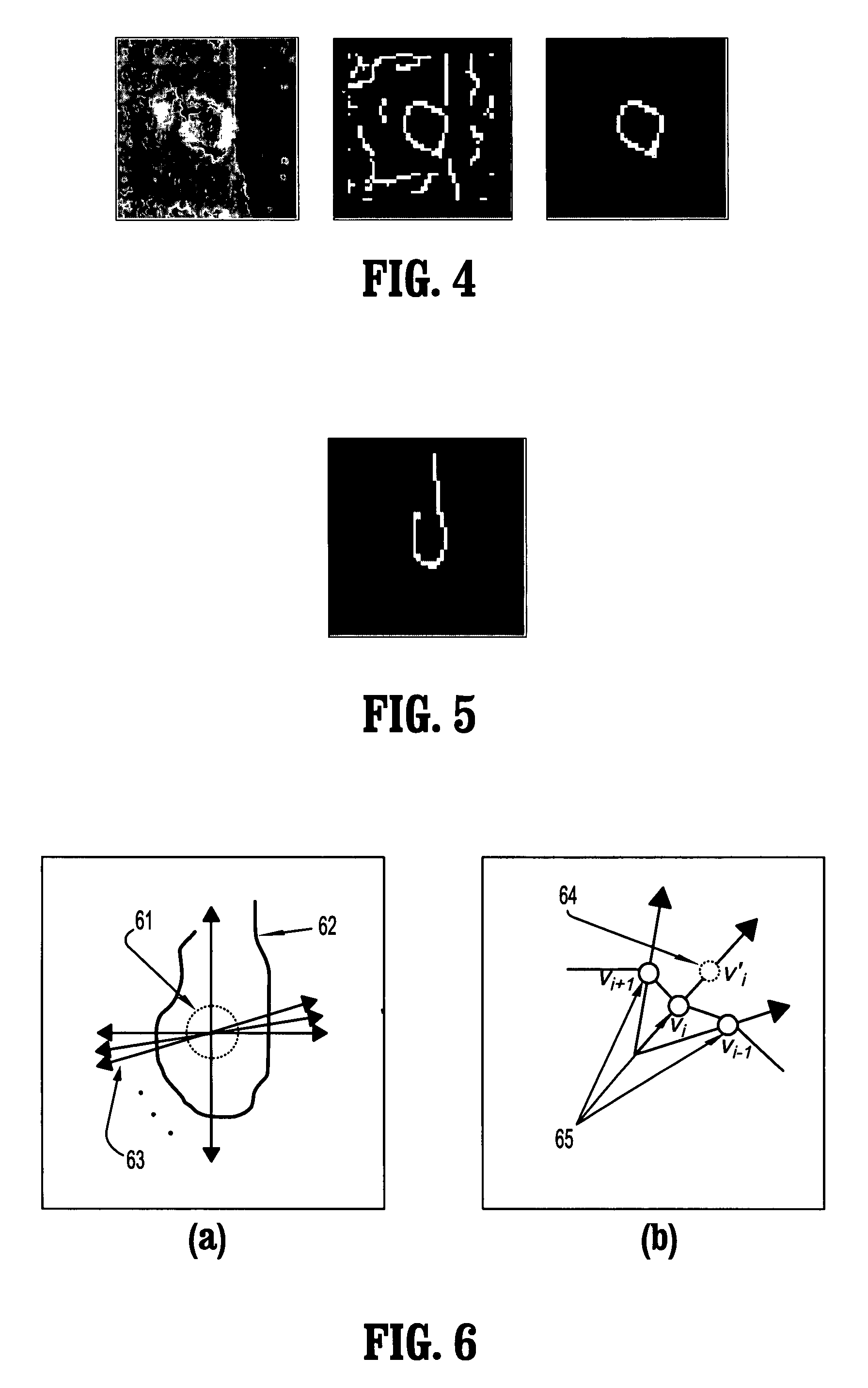 System and method for tracing rib posterior in chest CT volumes