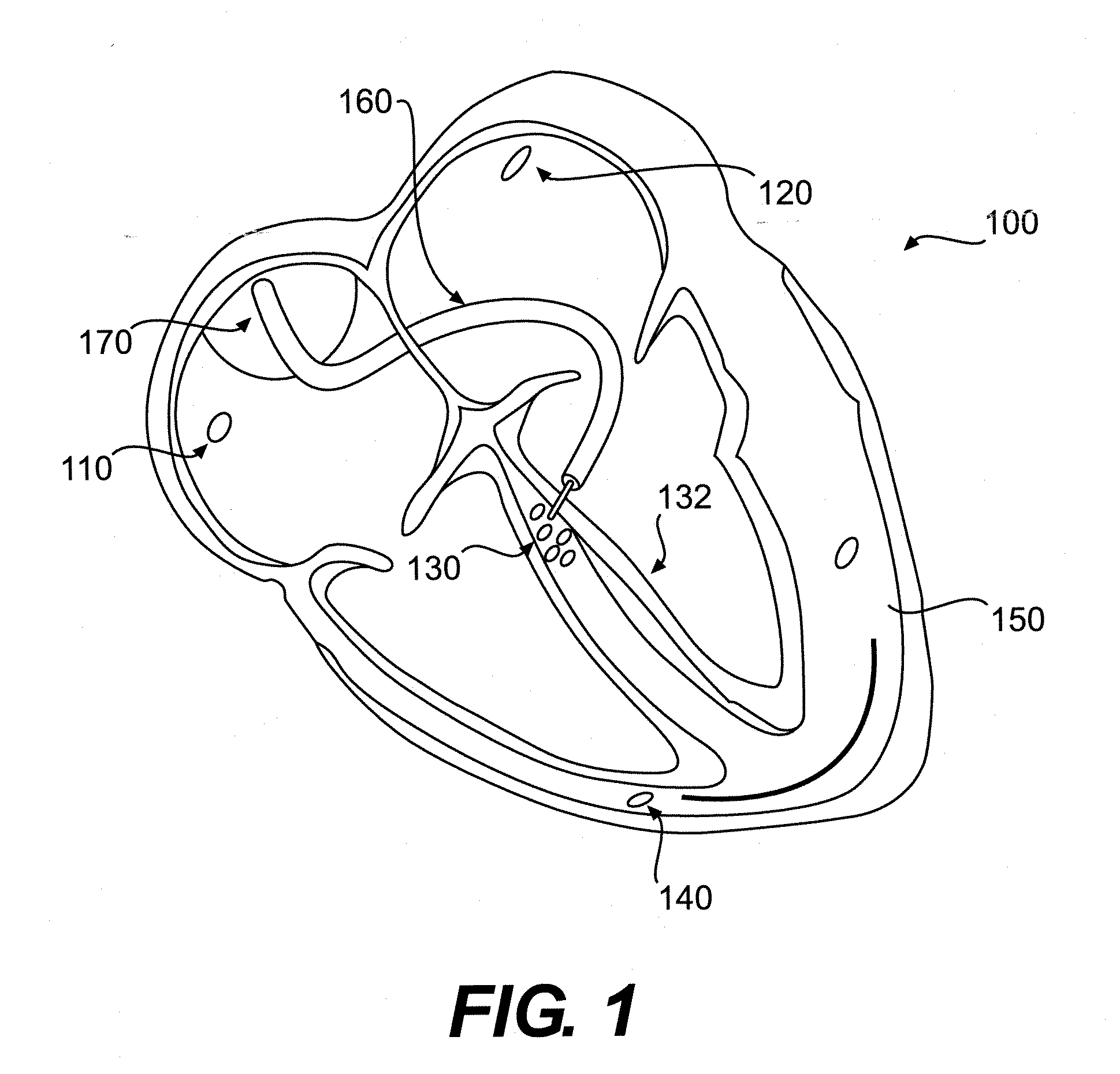 System and method for determining the origin of a sensed beat