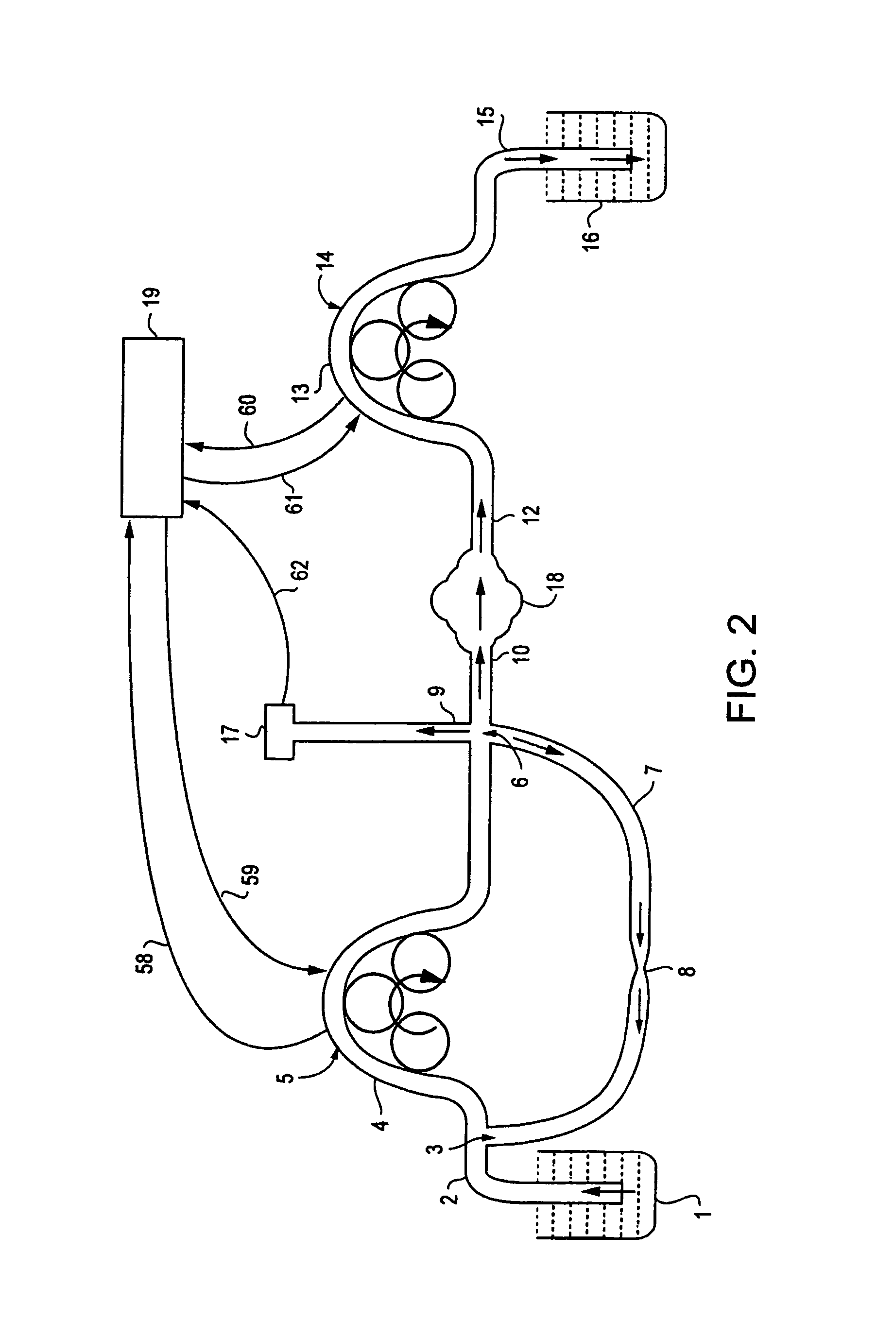 Low turbulence fluid management system for endoscopic procedures