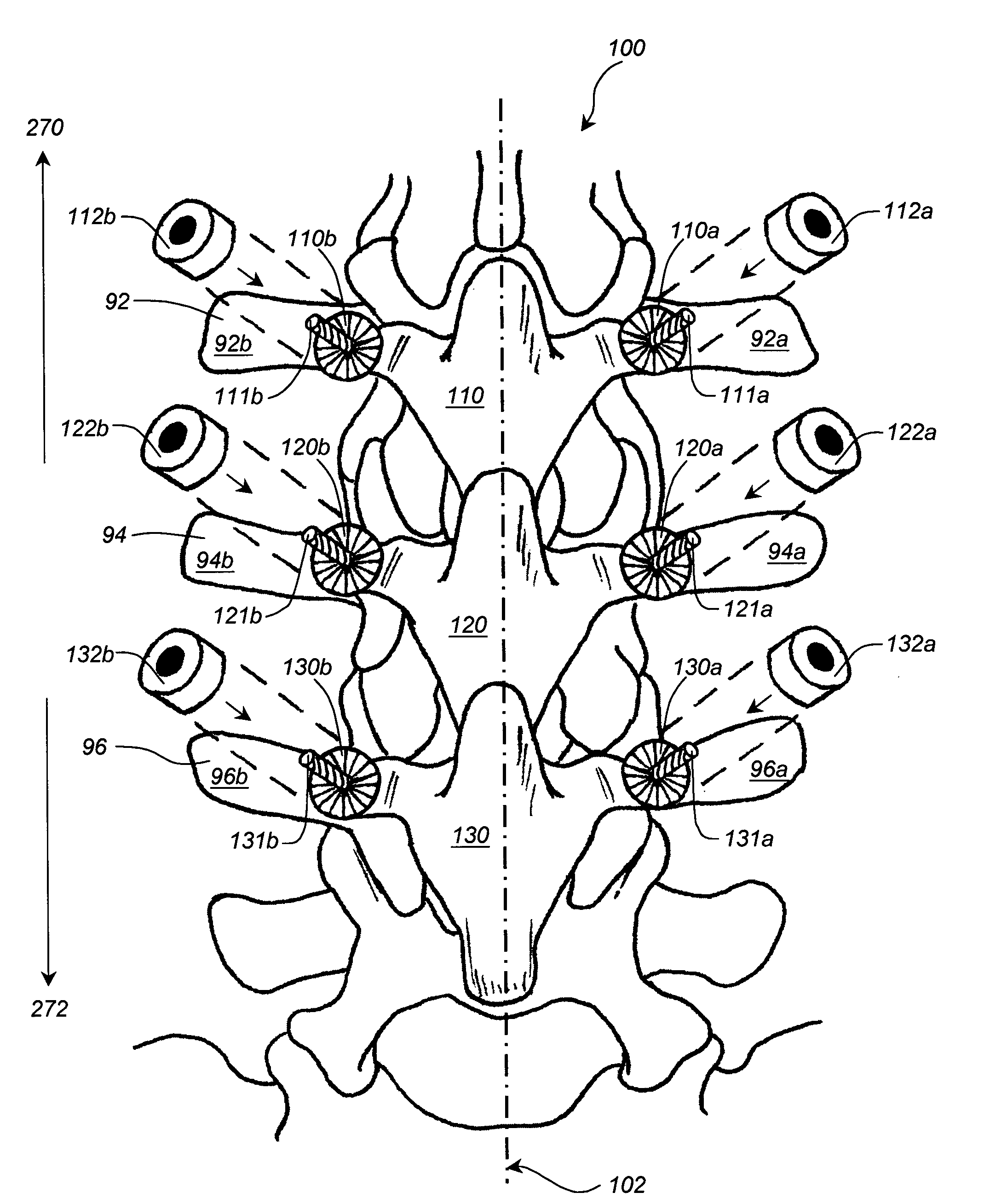 Apparatus and method for connecting spinal vertebrae