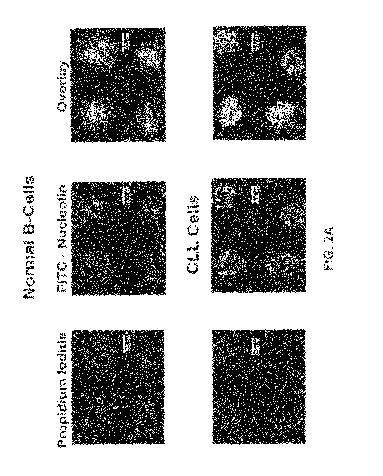 Human monoclonal antibodies to human nucleolin