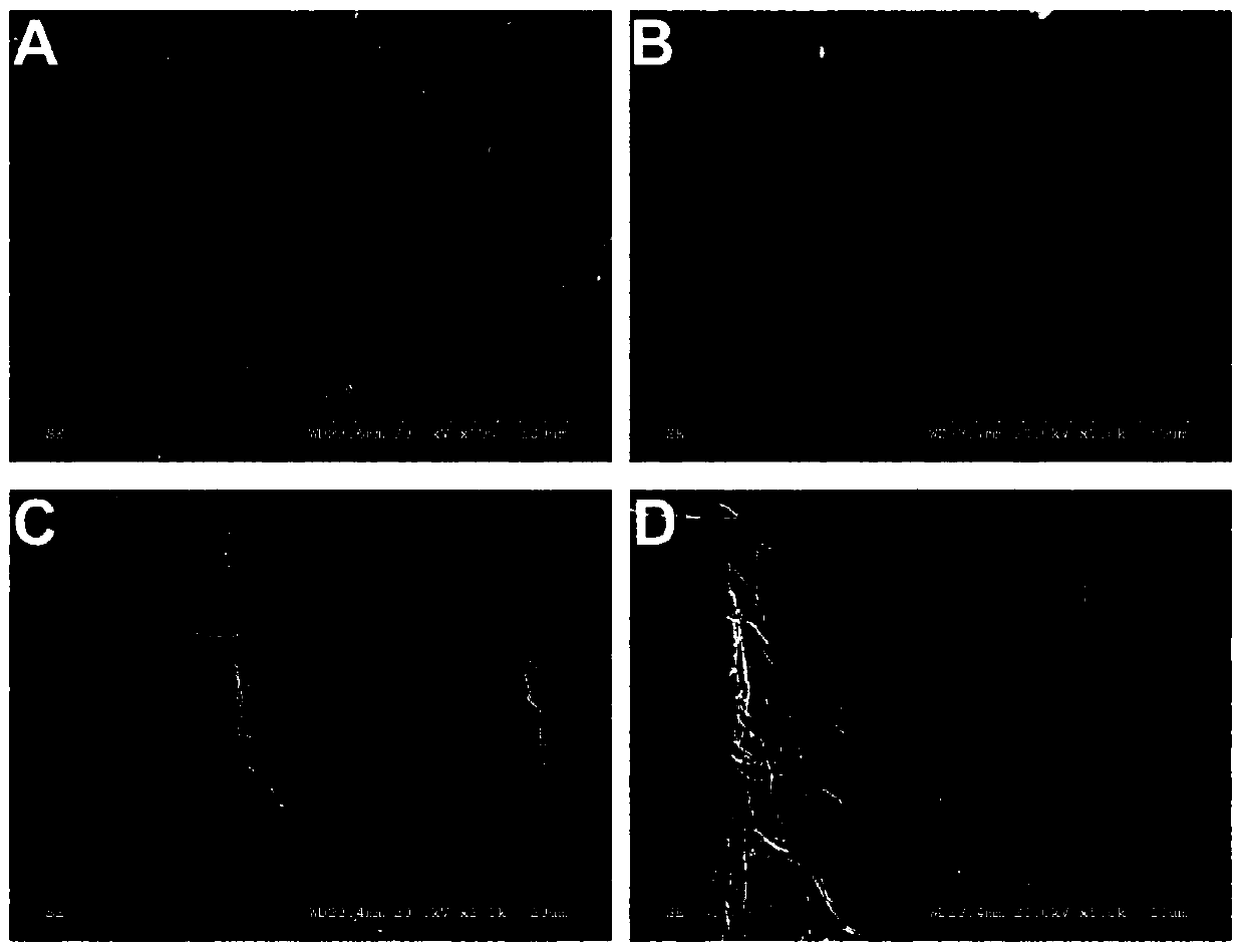 Acellular matrix inside-out repair material as well as preparation method and application thereof